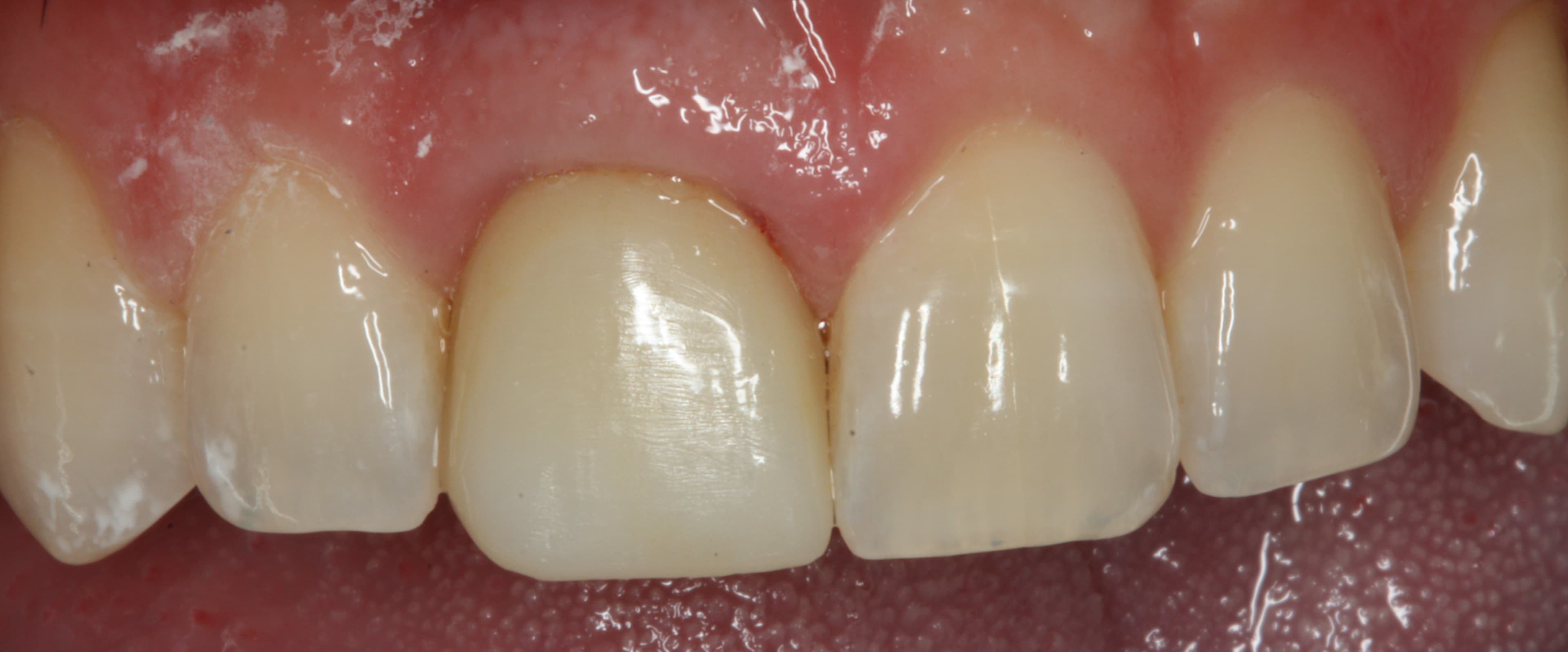 after image