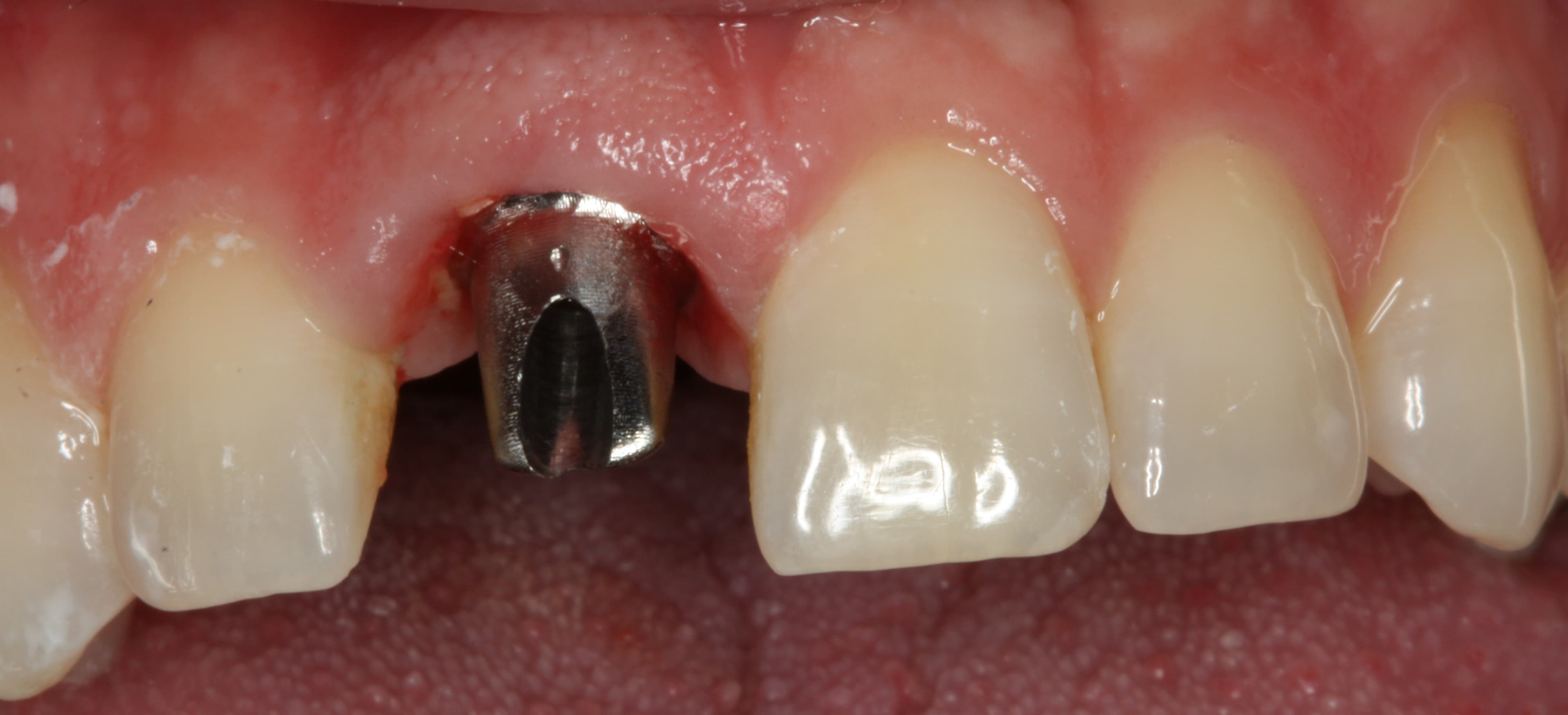 before image