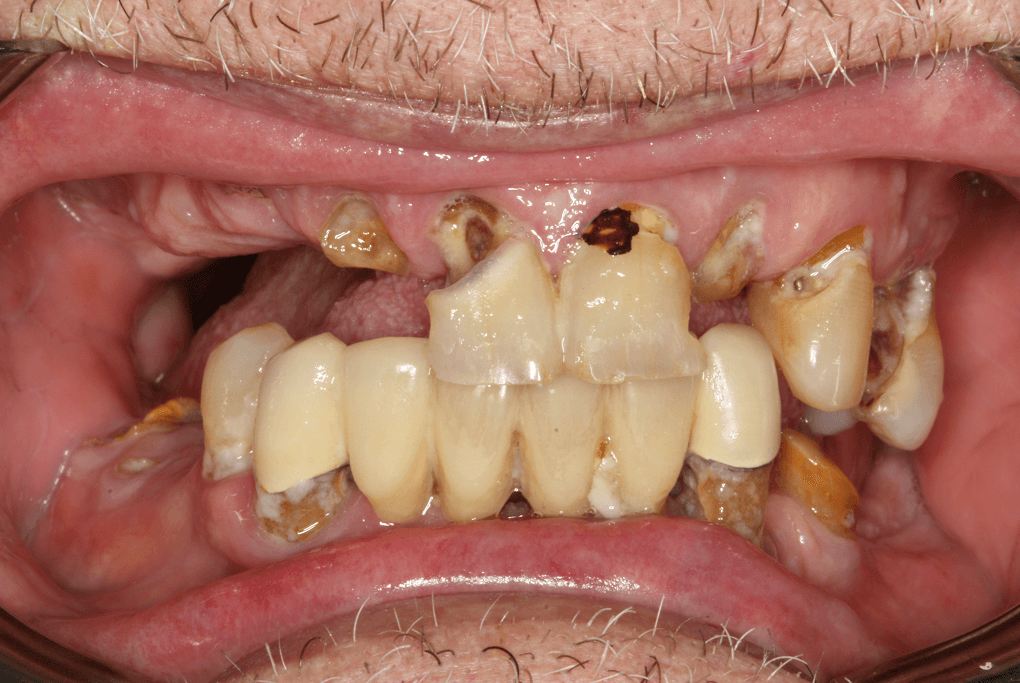 before image