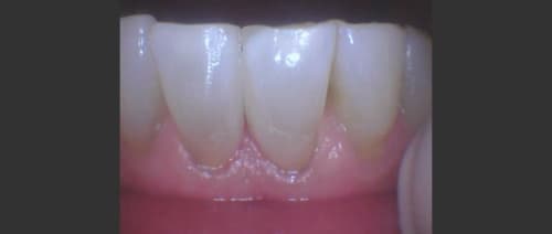 after image