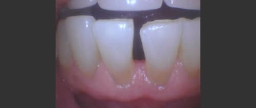 before image