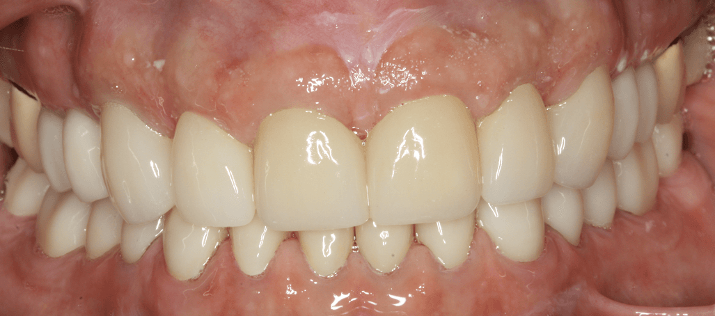 after image