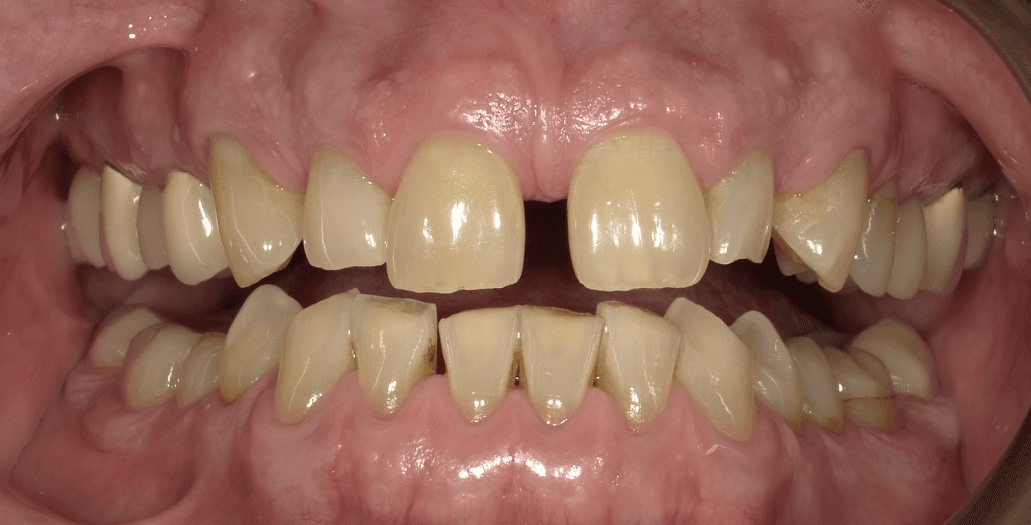 before image