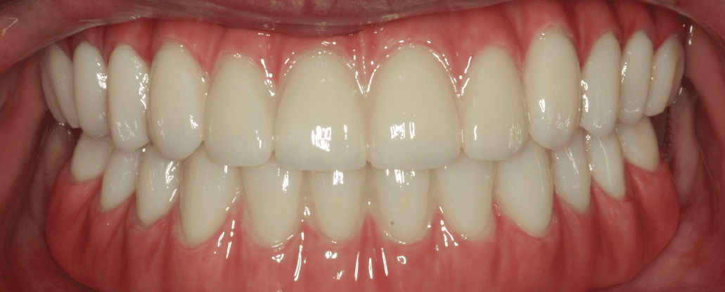 after image
